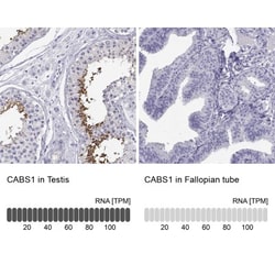 CABS1 Antibody, Novus Biologicals 25 &mu;L | Buy Online | Novus Biologicals | Fisher Scientific
